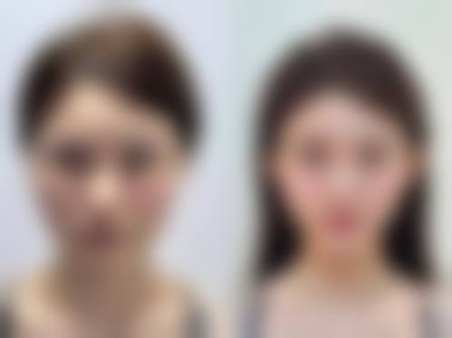 深圳青莲医疗美容门诊部顾客实例