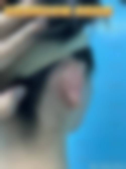 谭榕医生做手术价格