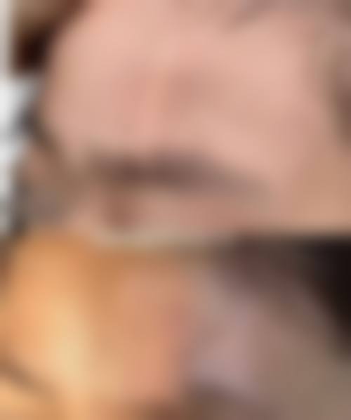 深圳昕美医疗美容诊所怎么样，可靠吗