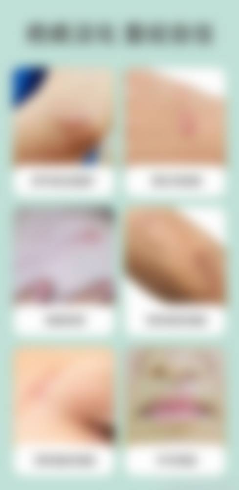 湖北省王伟民医生技术成熟吗——武汉涵美医疗美容门诊部