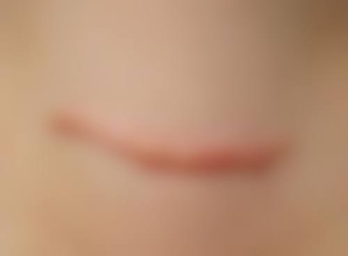 深圳青莲医疗美容门诊部更擅长什么