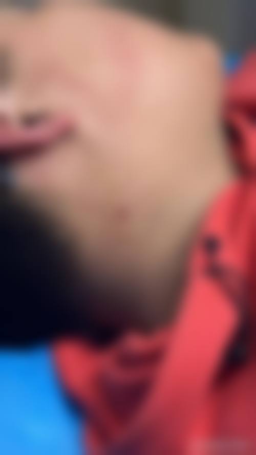 杭州西美医疗美容口碑好不好