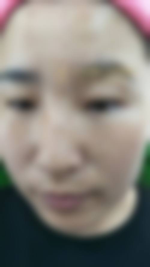 张高欣医生口碑如何