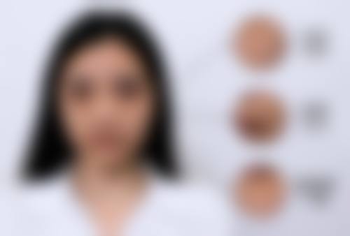 四、莆田学院附属医院整形美容科项目特色：多样项目的独特魅力