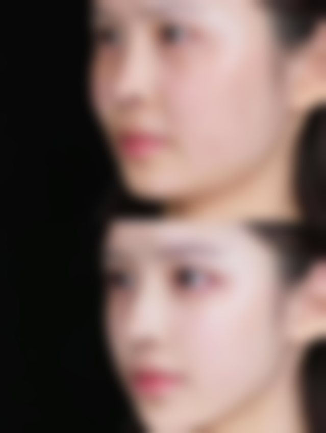 男士去眼袋方法有哪些:按摩与冰敷——日常护理的贴心妙招