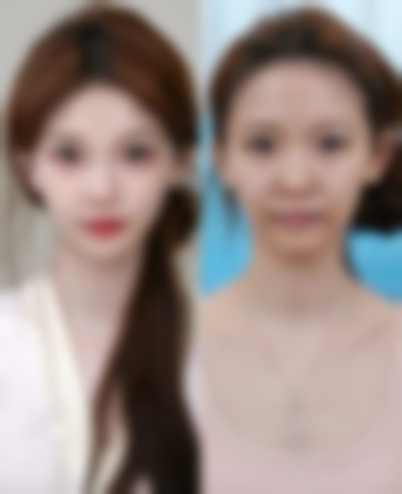 儿童专科医院:温和治疗呵护儿童疤痕增生