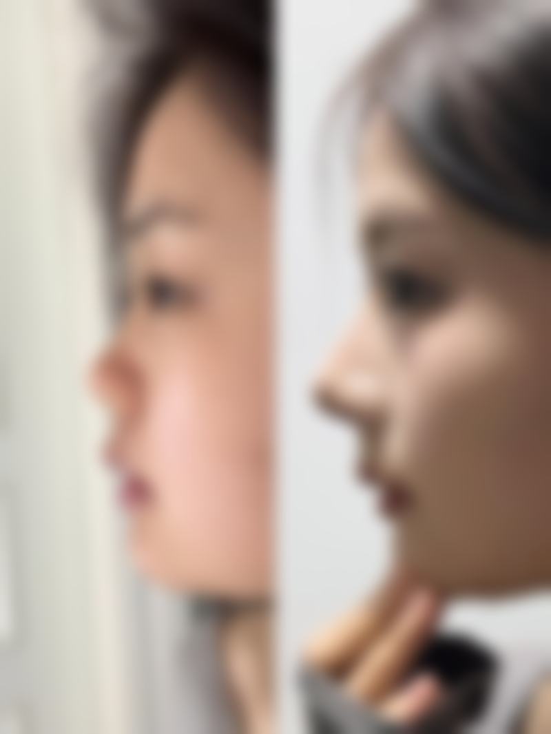 杭州季小白医疗美容诊所更擅长什么手术