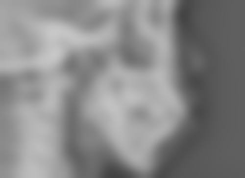 额头摔伤缝针的疤痕怎么去？3种医美方案+日常护理全攻略