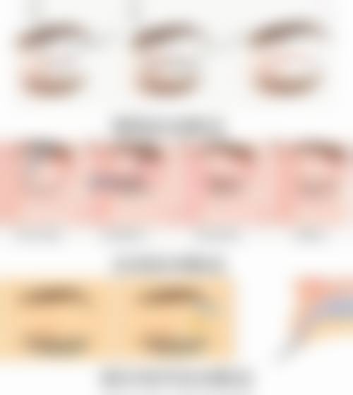 国有医院的瘦脸针剂量标准：安心保守的选择