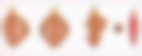 大腿吸脂术后同房黄金指南:6个tips让你安心又愉悦