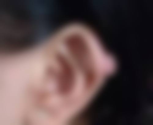 不同级别医院自体脂肪移植隆胸的成效好吗：差异对比与选择建议