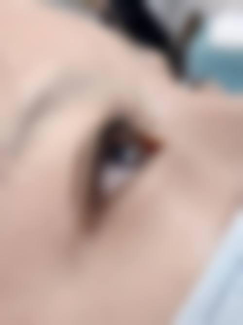 常秀芬医生简介做手术价格