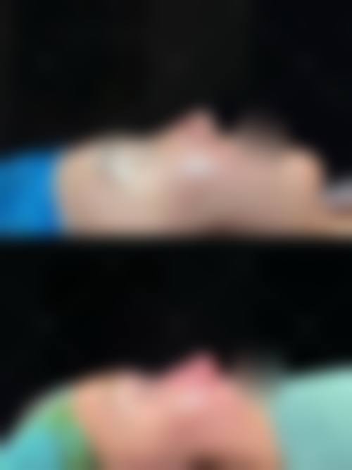 沈膺盛医生做手术价格