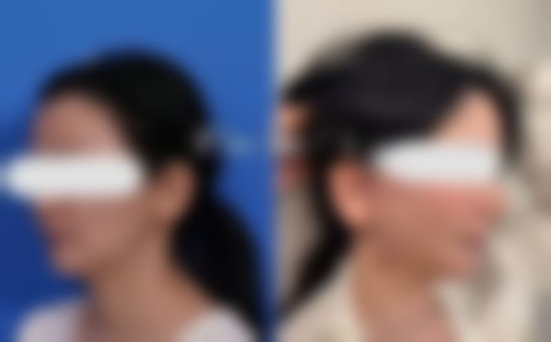 周金芳医生简介项目优势