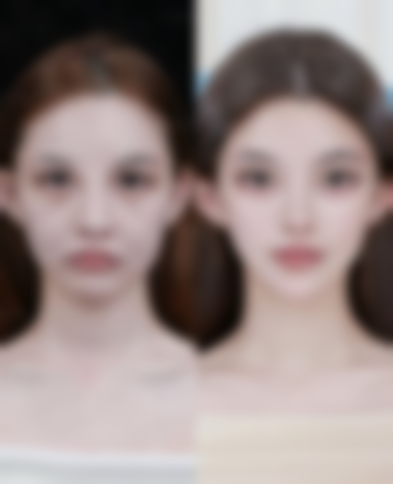 假体隆胸喂奶会下垂吗之改善下垂的日常护理