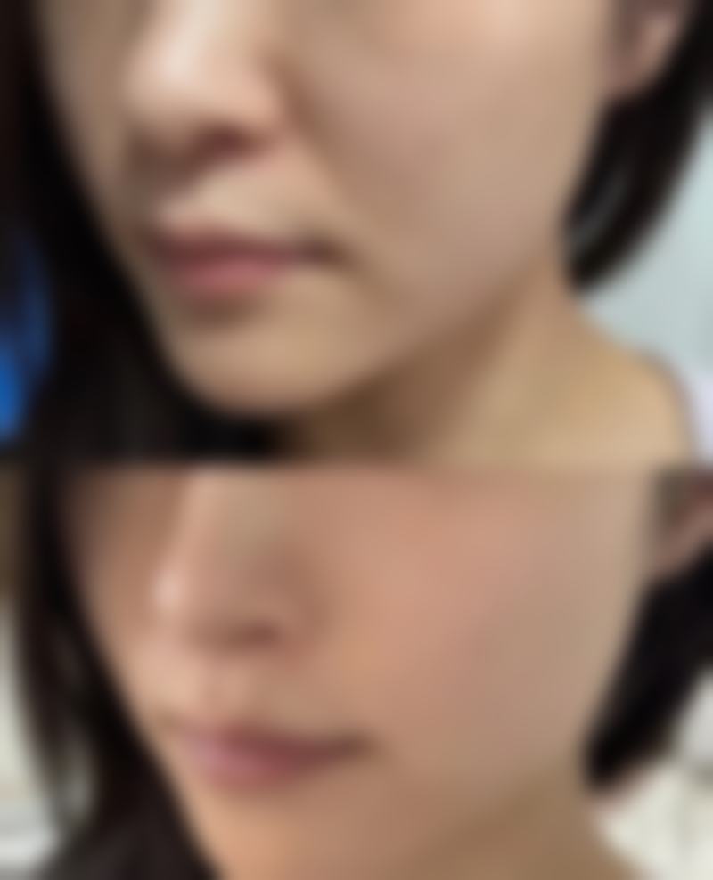 国内医学科学 院北京协和医院史迪医生做手术价格详情