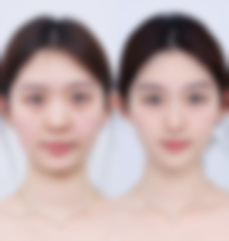 七、巴中悦莱美整形医院怎么样——口碑好不好？附真实患者口碑评价