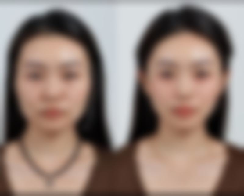 韩国IN整形外科怎么样？正规吗