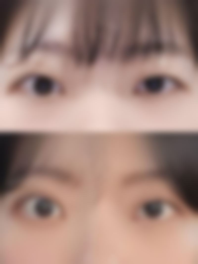 彬哲源医生简介做手术价格