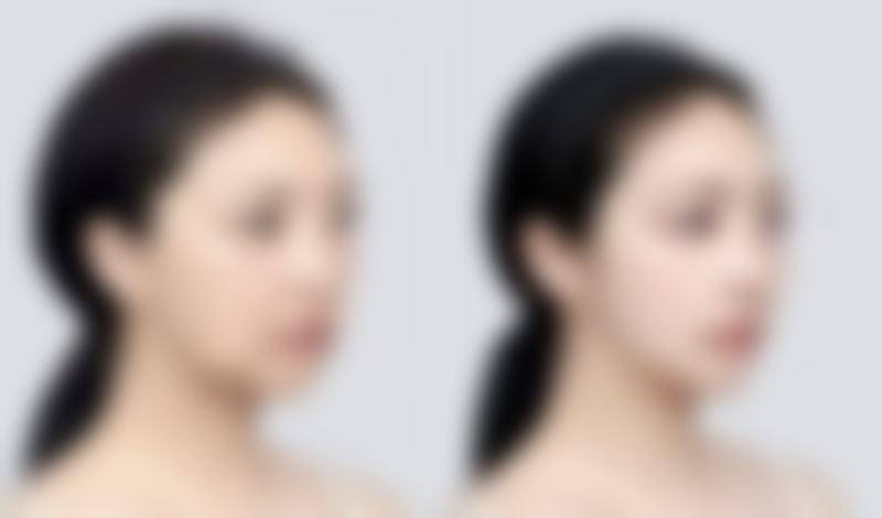 双眼皮下垂怎么做:日常护理要点