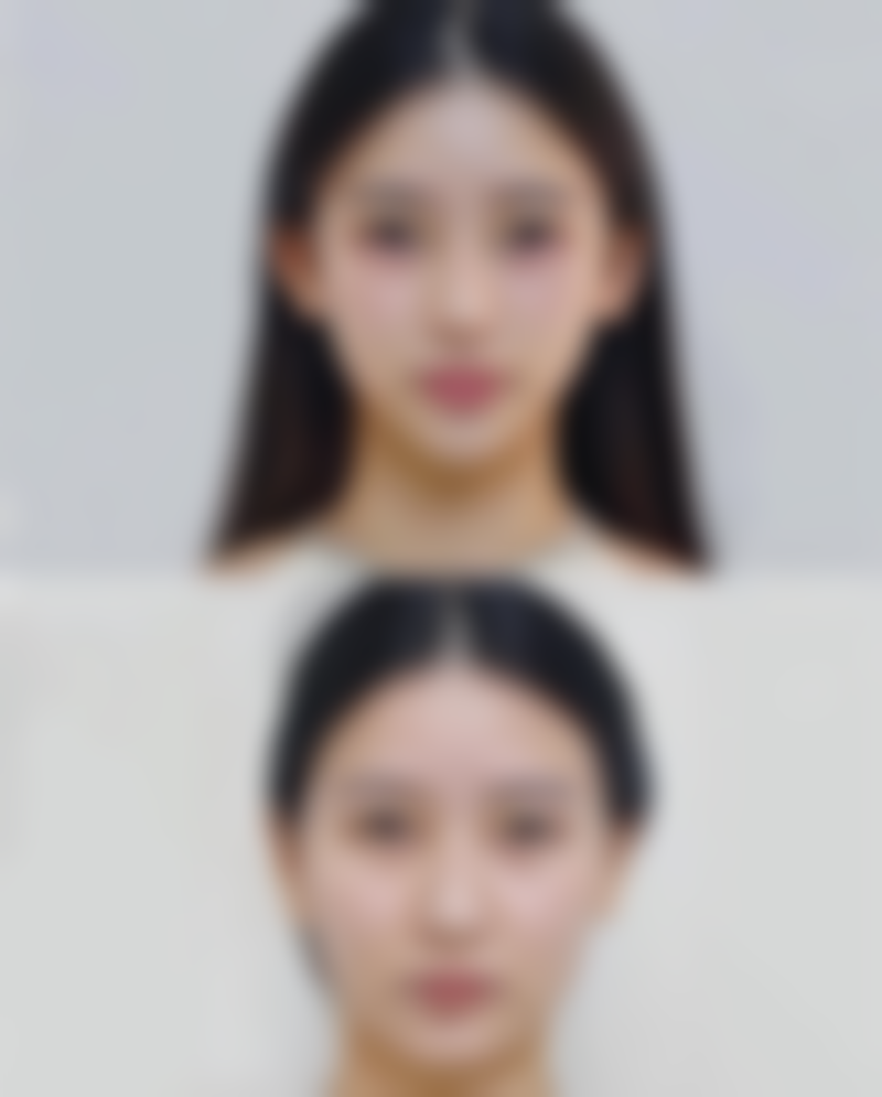 假体隆胸喂奶会下垂吗之改善下垂的运动锻炼