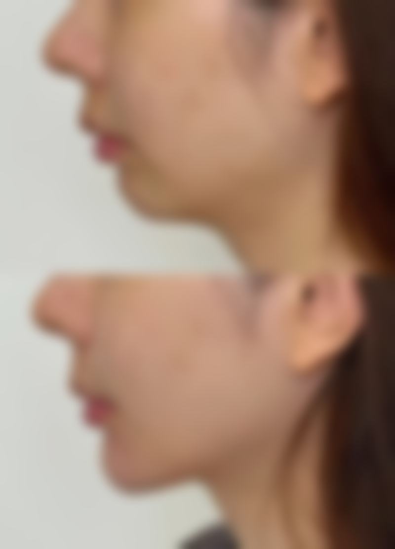 韩国SKY整形外科抖音团购活动及价格表