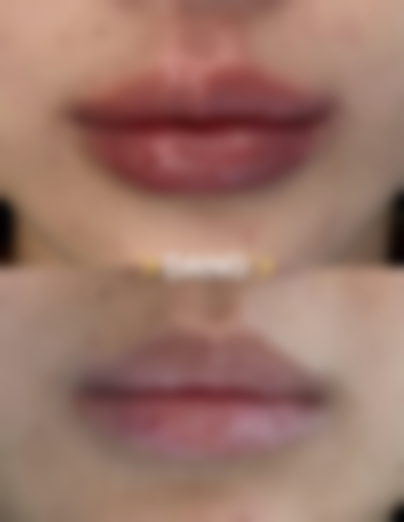 医生的贴心悄悄话:修复因人而异,谨慎对待