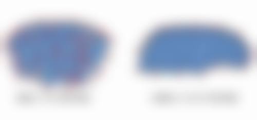 补充胶原蛋白,促进了胶原蛋白的合成。