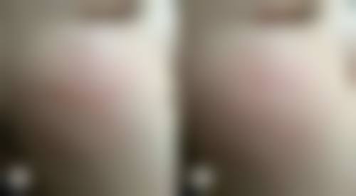 汉中市中 心医院(医疗美容·整形外科)价格表