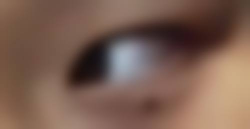 补充胶原蛋白可以增加皮肤张力,减少了皮肤的弹性和韧性,促进了皮肤的新陈代谢。