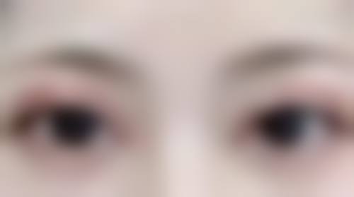 美皮护淡化疤痕红印的原理是什么