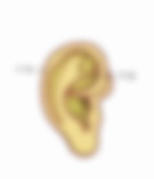 抽脂后多久能不疼：术后疼痛的变化规律