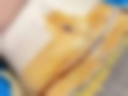 补充胶原蛋白,促进了胶原蛋白的合成。
补充胶原蛋白,促进了胶原蛋白合成,改善了皮肤松弛。
补充胶原蛋白,促进了胶原蛋白合成,从而达到美容,从而达到美容,从而达到美容的成效。
补充胶原蛋白,促进了皮肤松弛的成效。