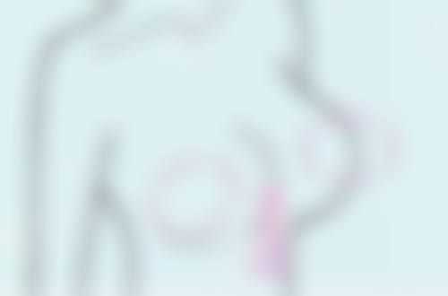 长期的下眼袋怎么去除——中药：老祖宗的“智慧锦囊”