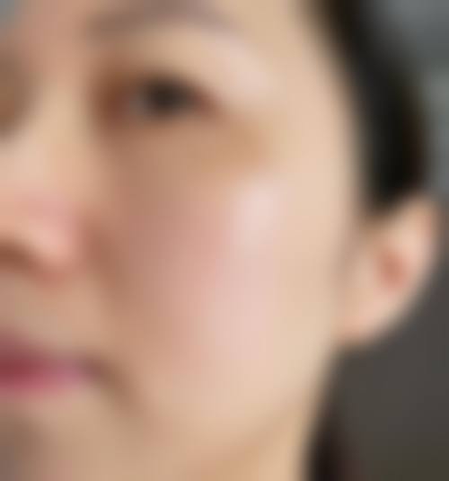 芦海玲医生顾客实例图片