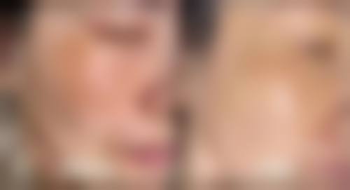 南昌美诺医疗美容门诊部怎么样?顾客实例