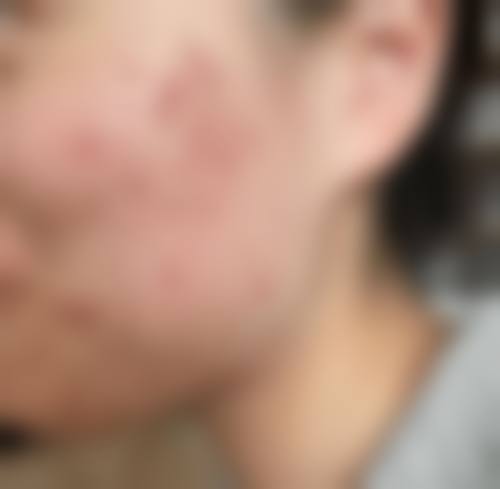 江油安丽维医疗美容诊所可靠吗