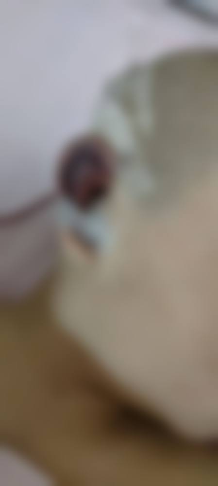 郑盛宇医生简介做手术价格