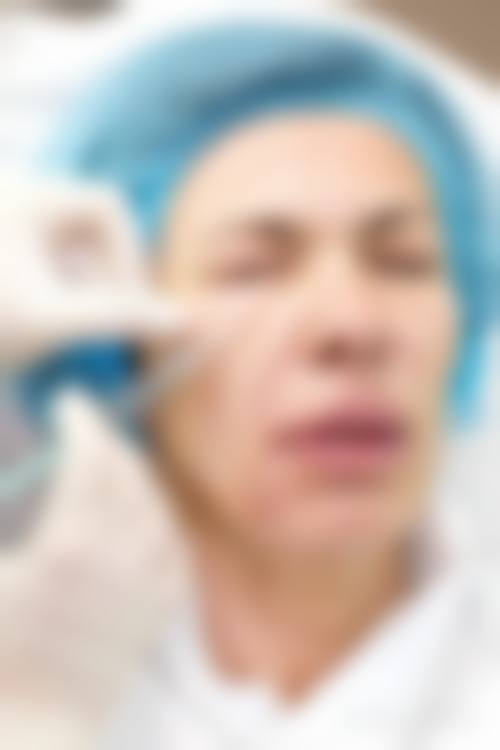 陈咸伸医生项目优势