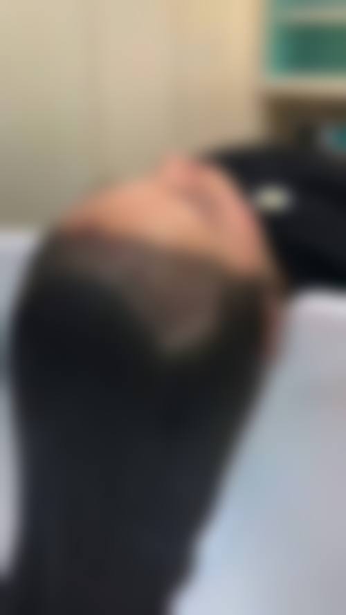 李喜文医生项目优势