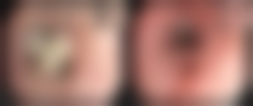 广州广美美妍医疗美容门诊部怎么样