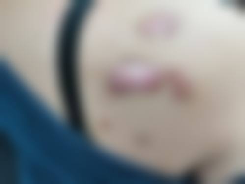 青岛本沐医疗整形美容诊所更擅长什么手术