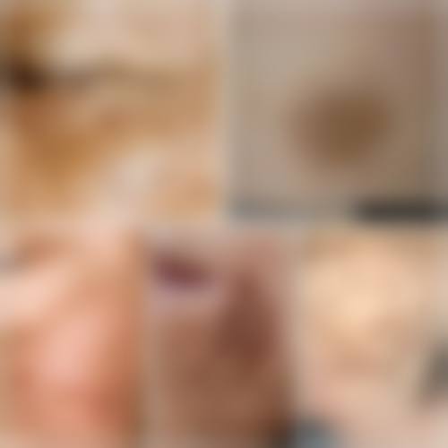 瞿翼敏医生顾客实例图片展示