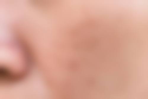 广州广美美妍医疗美容门诊部顾客实例