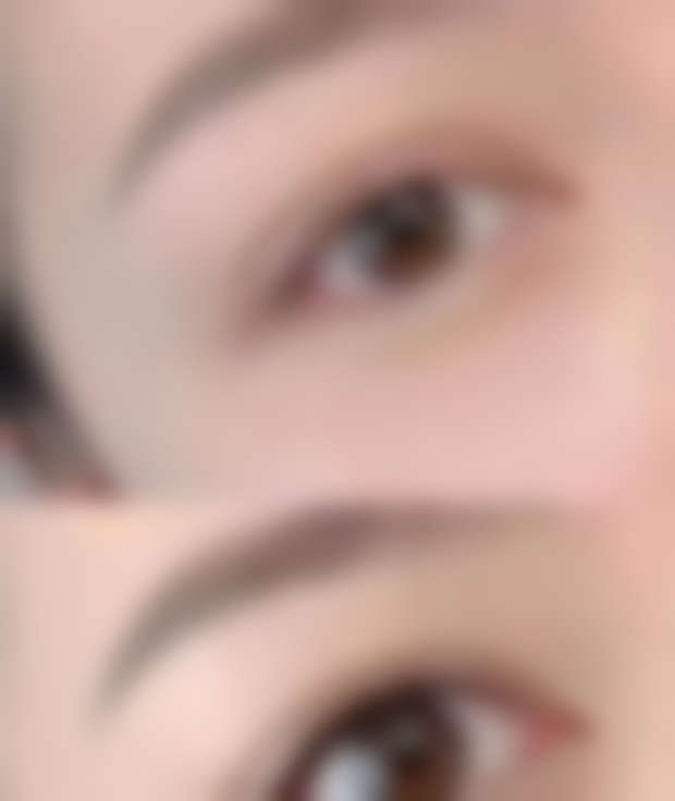 去除黑眼袋用什么眼膜更能急救：应对突发状况的救星