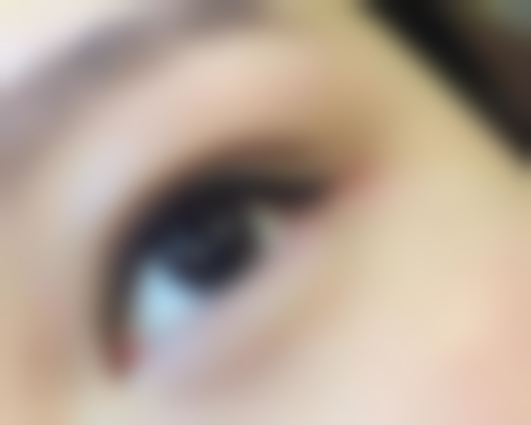 长期的下眼袋怎么去除——食疗：吃出来的“明亮双眸”