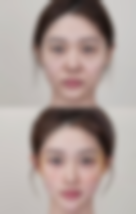 美皮护淡化疤痕红印的副作用及注意事项