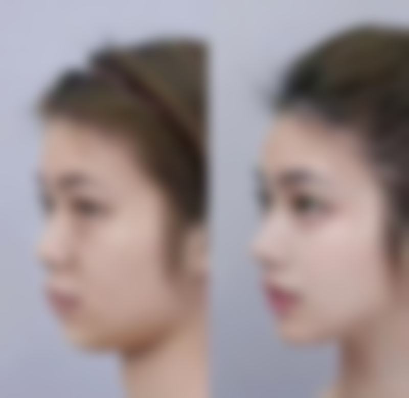 告别“熊猫眼”,重拾明亮双眸