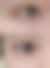 深圳市蛇口人民医院烧伤整形科怎么样，口碑评价如何？