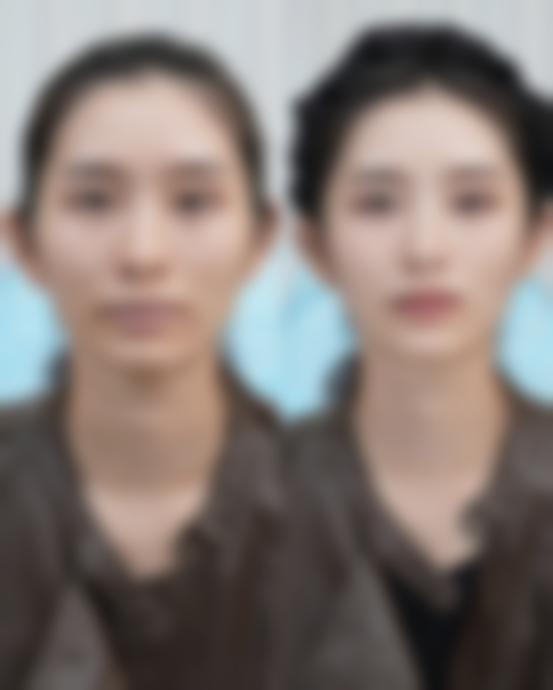 补充胶原蛋白,促进了胶原蛋白的合成。